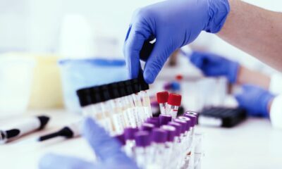 Various Drug Testing Methods in the Employment Process