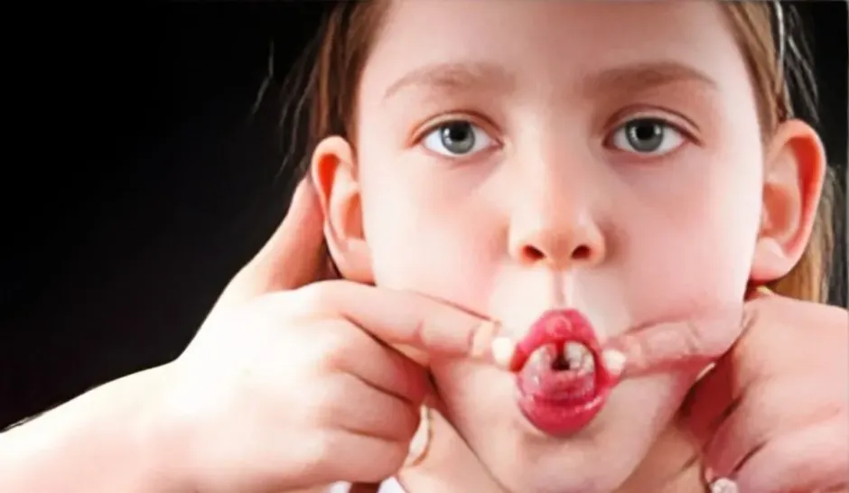 Unveiling the Art of Trixie Tongue Tricks: A Journey into Playful Linguistics